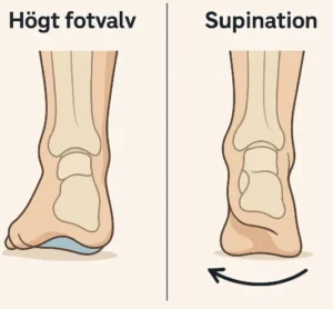 Högt fotvalv och supination